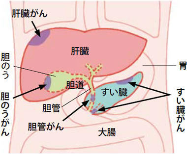 消化器のがん「肝臓がん」