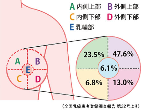 乳がんの危険因子