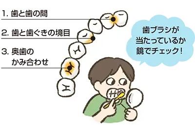 図解:プラークのたまりやすいところ